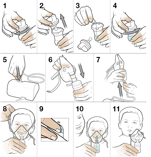 How to nebulize baby